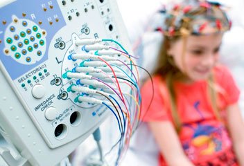Exame EEG Exame EEG